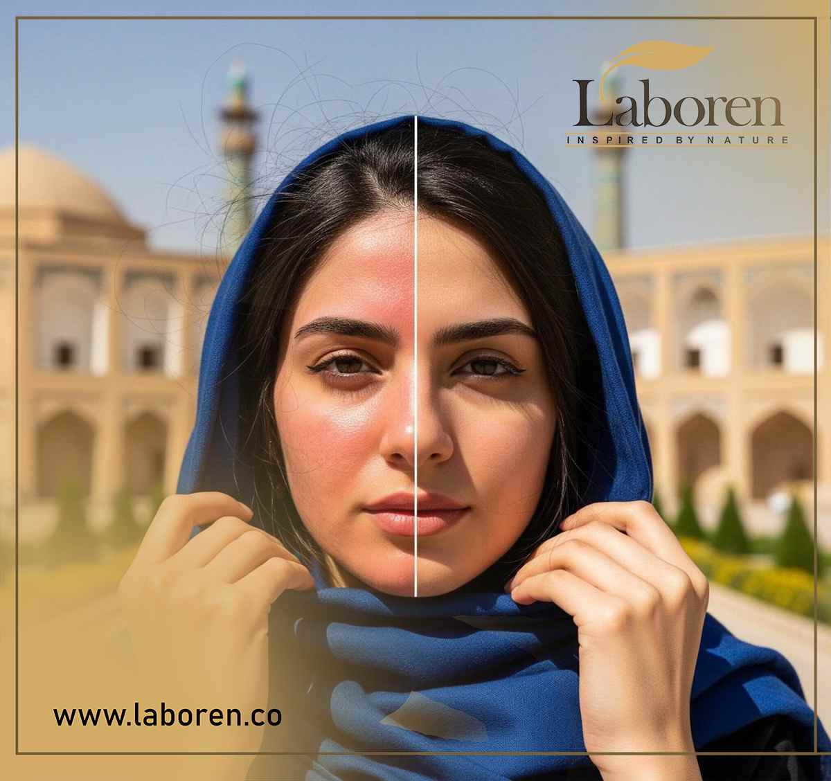 بدون ضدآفتاب چه بر سر پوستتان میآید